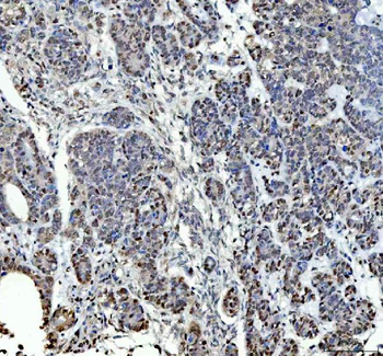 P15RS/RPRD1A Rabbit Polyclonal Antibody