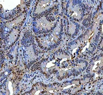 P15RS/RPRD1A Rabbit Polyclonal Antibody