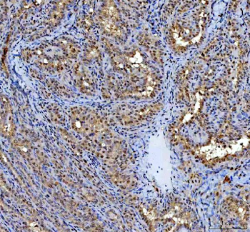 P15RS/RPRD1A Rabbit Polyclonal Antibody