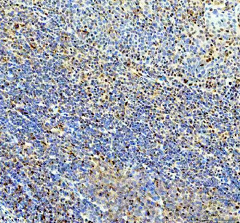 P15RS/RPRD1A Rabbit Polyclonal Antibody