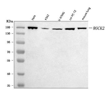 ROCK2 Rabbit Polyclonal Antibody