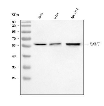 RNMT Rabbit Polyclonal Antibody
