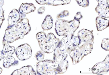 RBM22 Rabbit Polyclonal Antibody