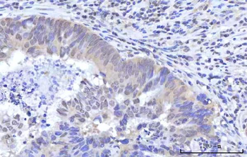 RBM22 Rabbit Polyclonal Antibody