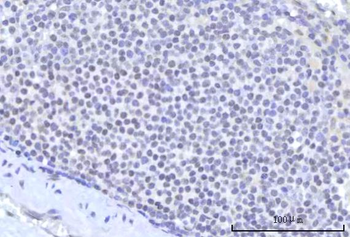 RBM22 Rabbit Polyclonal Antibody