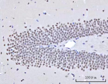 RBM22 Rabbit Polyclonal Antibody