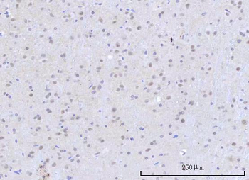RBM22 Rabbit Polyclonal Antibody