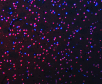 RBM22 Rabbit Polyclonal Antibody