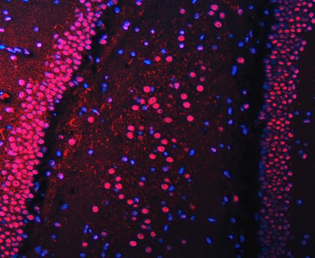 RBM22 Rabbit Polyclonal Antibody
