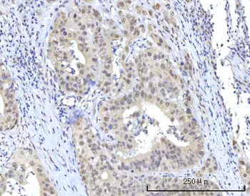 RBM22 Rabbit Polyclonal Antibody