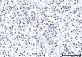 RBM22 Rabbit Polyclonal Antibody