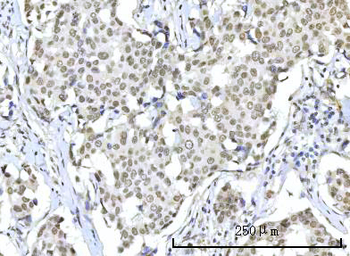 RBM22 Rabbit Polyclonal Antibody