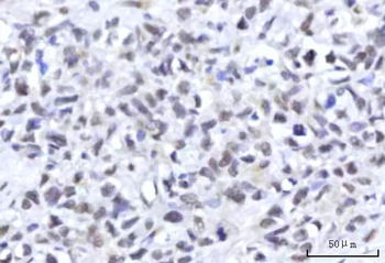RBM22 Rabbit Polyclonal Antibody