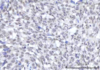 RBM22 Rabbit Polyclonal Antibody
