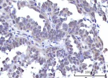 RBM22 Rabbit Polyclonal Antibody