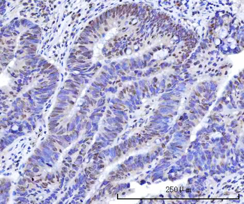 RBM15B Rabbit Polyclonal Antibody