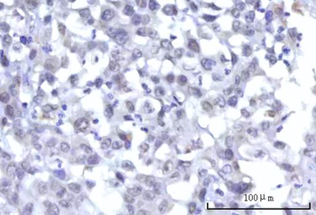 RBM15B Rabbit Polyclonal Antibody