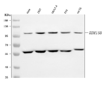 RBM15B Rabbit Polyclonal Antibody