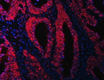 RBM15B Rabbit Polyclonal Antibody