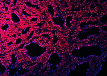 RBM15B Rabbit Polyclonal Antibody