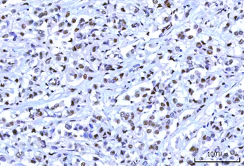 RBM15B Rabbit Polyclonal Antibody