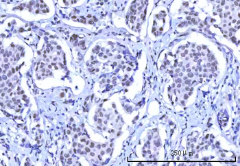 RBM15B Rabbit Polyclonal Antibody