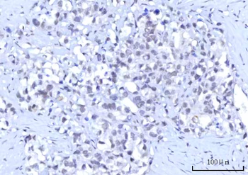 RBM15B Rabbit Polyclonal Antibody