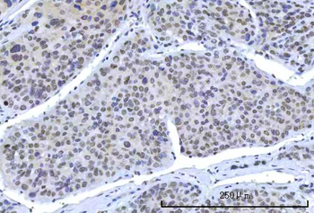 RBM15B Rabbit Polyclonal Antibody