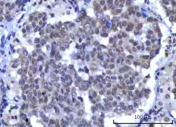 RBM15B Rabbit Polyclonal Antibody