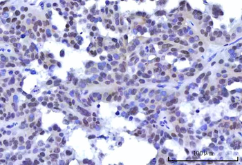 RBM15B Rabbit Polyclonal Antibody