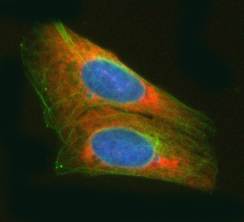 RARS/RARS1 Rabbit Polyclonal Antibody