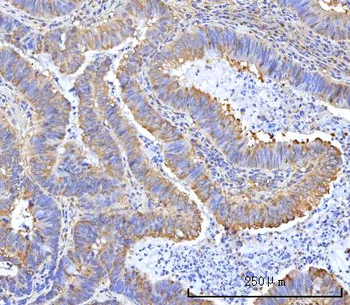 RARS/RARS1 Rabbit Polyclonal Antibody