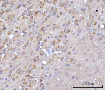 RARS/RARS1 Rabbit Polyclonal Antibody