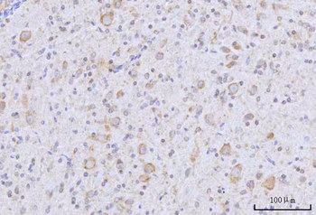 RARS/RARS1 Rabbit Polyclonal Antibody