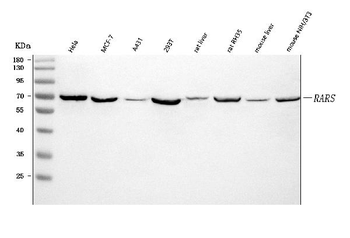 RARS/RARS1 Rabbit Polyclonal Antibody