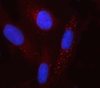 GCM1 Rabbit Polyclonal Antibody