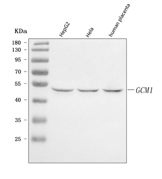 GCM1 Rabbit Polyclonal Antibody