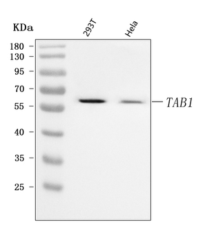 TAB1 Rabbit Polyclonal Antibody