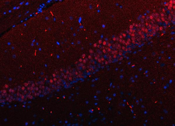 RFX3 Rabbit Polyclonal Antibody