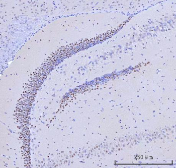 RFX3 Rabbit Polyclonal Antibody