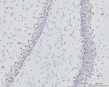 RFX3 Rabbit Polyclonal Antibody