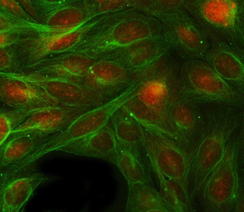 RBP1 Rabbit Polyclonal Antibody