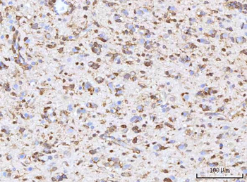 RBP1 Rabbit Polyclonal Antibody