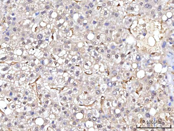 RBP1 Rabbit Polyclonal Antibody