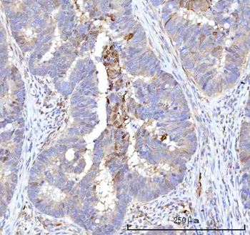 RBP1 Rabbit Polyclonal Antibody