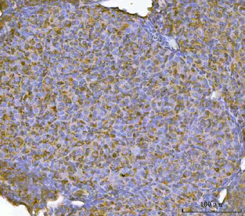 RBP1 Rabbit Polyclonal Antibody