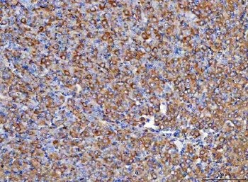 RBP1 Rabbit Polyclonal Antibody