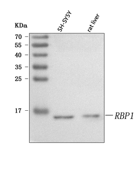 RBP1 Rabbit Polyclonal Antibody