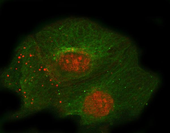 Thrombomodulin/THBD Rabbit Polyclonal Antibody