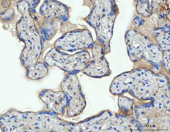 Thrombomodulin/THBD Rabbit Polyclonal Antibody